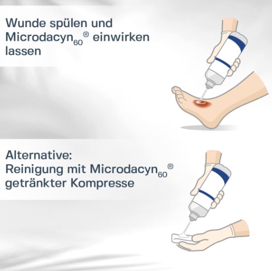 Anwendung Microdacyn Lösung