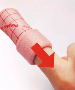 PolyMem-Finger-Anlegen-3